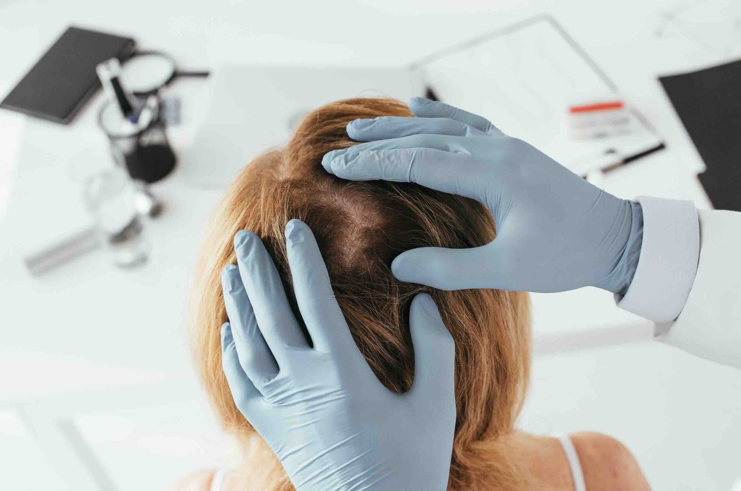 consulenza tricologica roma