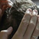 trattamento dermatite psoriasi cute roma