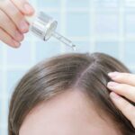 trattamento dermatite psoriasi cute roma