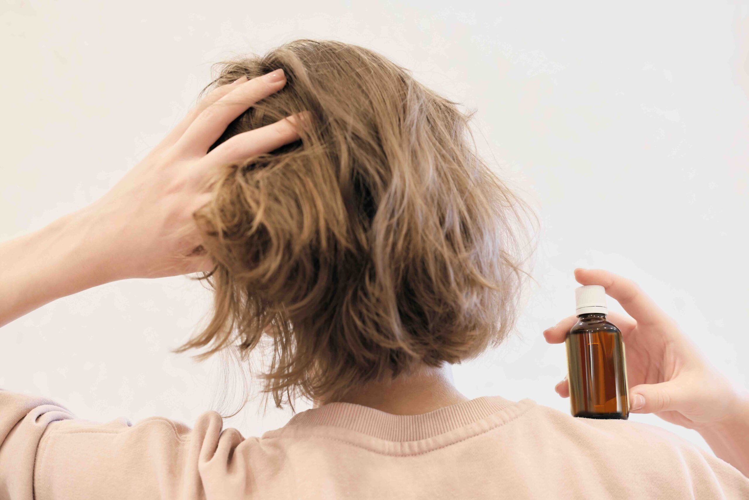 trattamento dermatite psoriasi cute roma