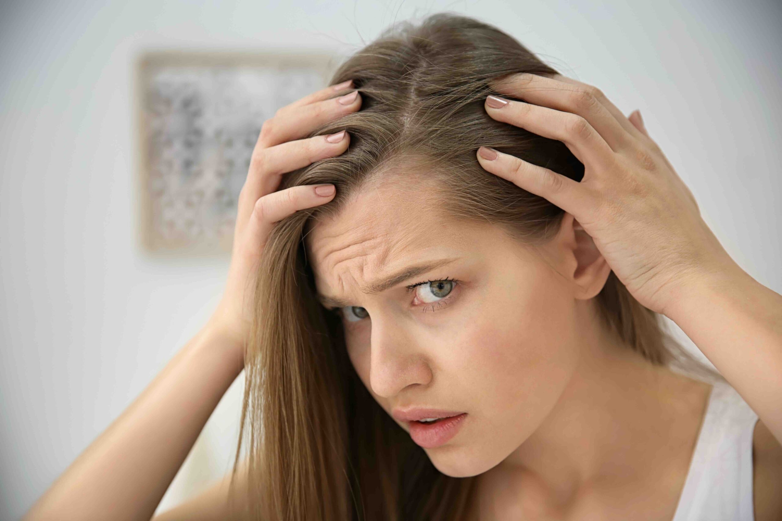 trattamento dermatite psoriasi cute roma