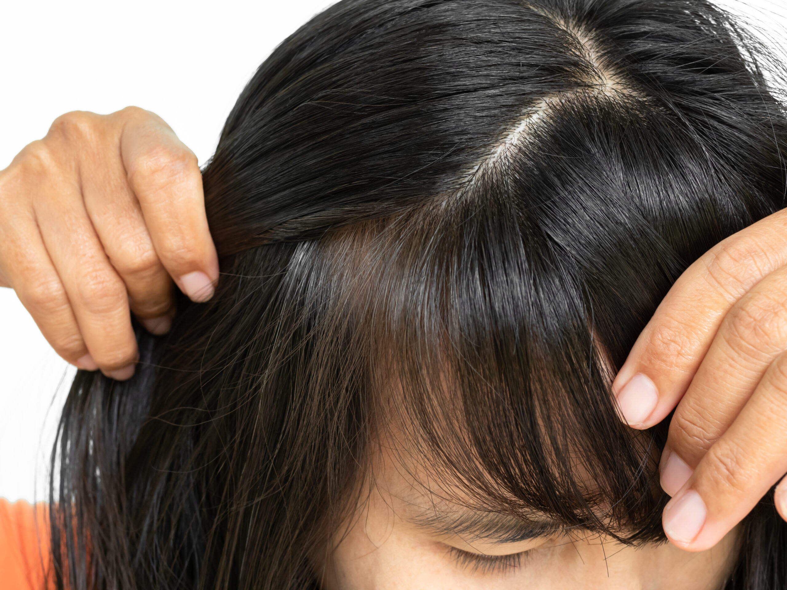 crescita capelli trattamento lenitivo cuoio capelluto roma